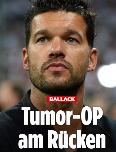 ballack (1)